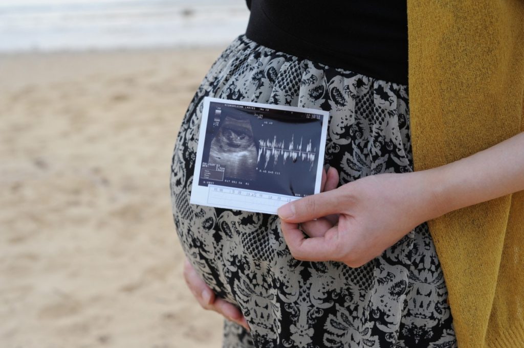 エコー写真を妊娠の経過別に紹介！写真の見方や性別の見分け方